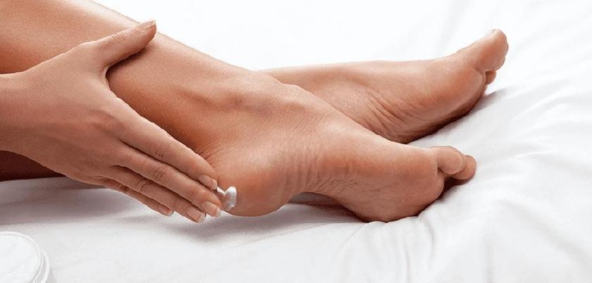 CRACKED HEELS 101: CAUSES, SYMPTOMS & TREATMENT