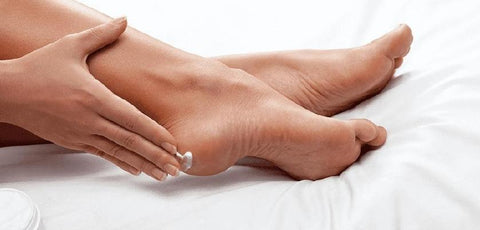 CRACKED HEELS 101: CAUSES, SYMPTOMS & TREATMENT